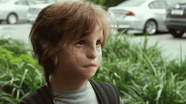 Sindrome Di Treacher Collins Aspettative Di Vita