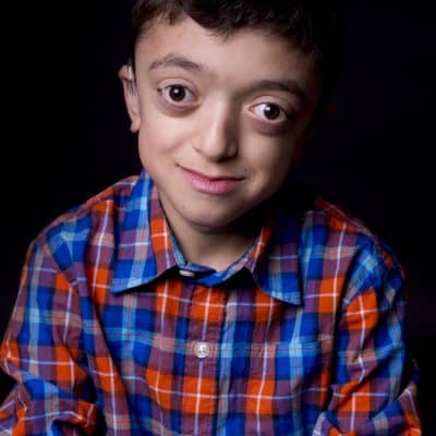 Ritratto ravvicinato di un bambino con sindrome di Crouzon che sorride, indossa una camicia a quadri colorati su sfondo nero – Altravoce Onlus