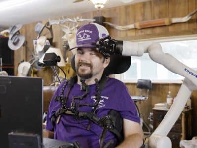 neuralink-bracci-robotici-altravoce